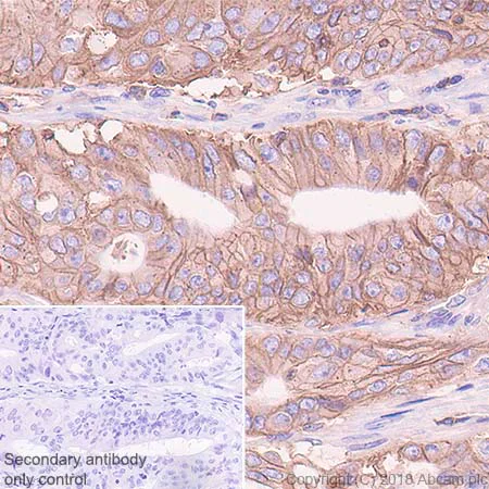 Immunohistochemistry (Formalin/PFA-fixed paraffin-embedded sections) - Anti-HLA Class 1 ABC antibody [EPR22172] - BSA and Azide free (AB239788)