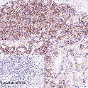 Immunohistochemistry (Formalin/PFA-fixed paraffin-embedded sections) - Anti-HLA Class 1 ABC antibody [EPR22172] - BSA and Azide free (AB239788)