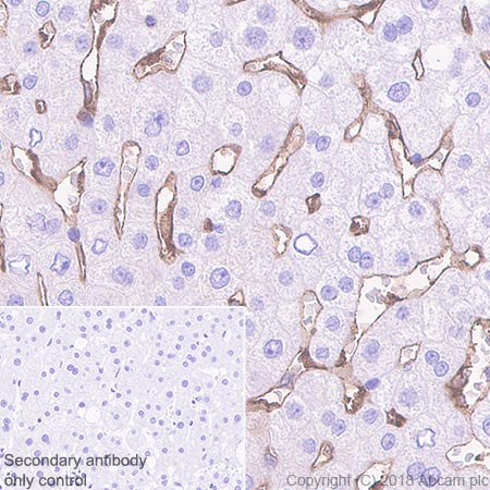 Immunohistochemistry (Formalin/PFA-fixed paraffin-embedded sections) - Anti-HLA Class 1 ABC antibody [EPR22172] - BSA and Azide free (ab239788), expandable thumbnail