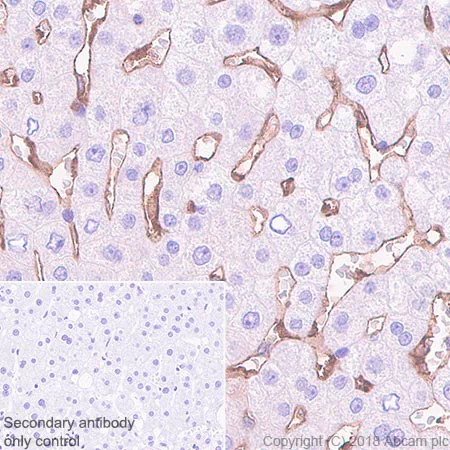 Immunohistochemistry (Formalin/PFA-fixed paraffin-embedded sections) - Anti-HLA Class 1 ABC antibody [EPR22172] - BSA and Azide free (AB239788)