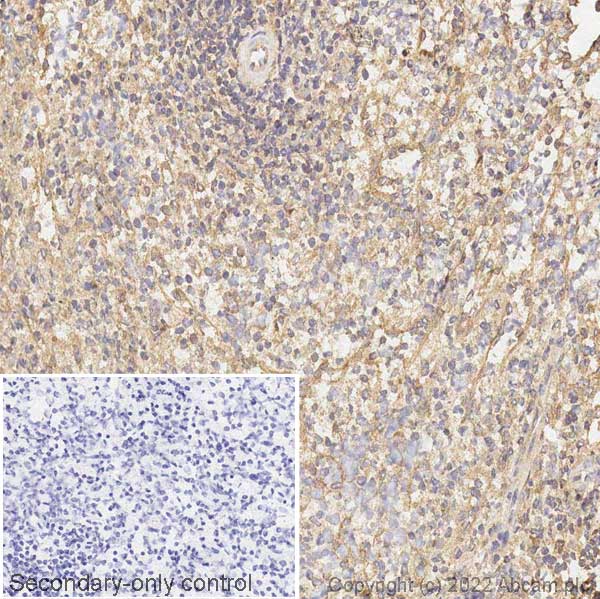 Immunohistochemistry (Frozen sections) - Anti-HLA Class 1 ABC antibody [EPR22172] - BSA and Azide free (ab239788), expandable thumbnail