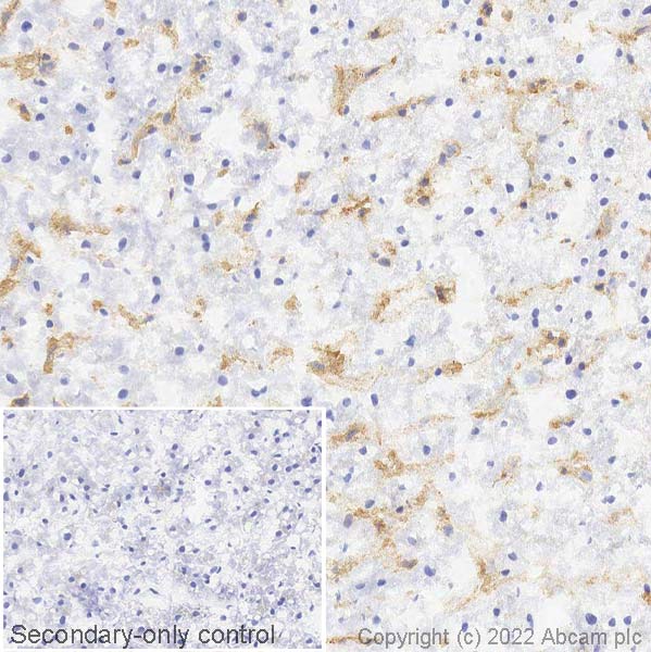 Immunohistochemistry (Frozen sections) - Anti-HLA Class 1 ABC antibody [EPR22172] - BSA and Azide free (ab239788), expandable thumbnail