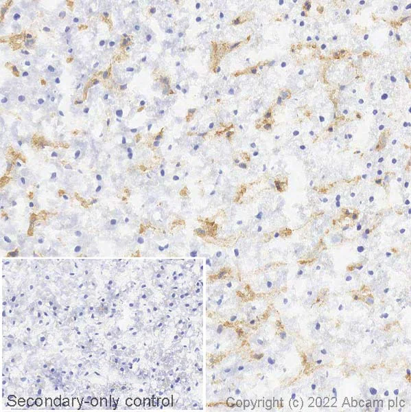 Immunohistochemistry (Frozen sections) - Anti-HLA Class 1 ABC antibody [EPR22172] - BSA and Azide free (AB239788)