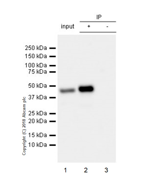 Immunoprecipitation - Anti-HLA Class 1 ABC antibody [EPR22172] - BSA and Azide free (AB239788), expandable thumbnail