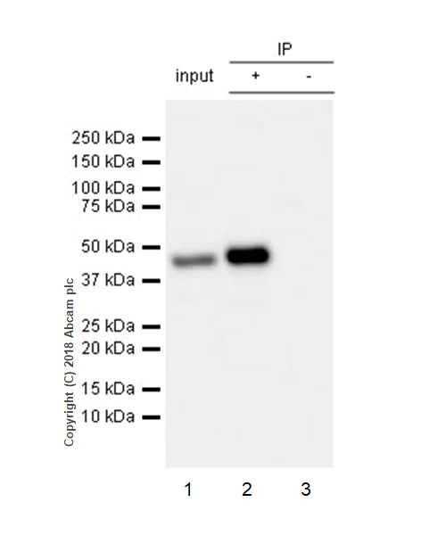 Immunoprecipitation - Anti-HLA Class 1 ABC antibody [EPR22172] - BSA and Azide free (AB239788)