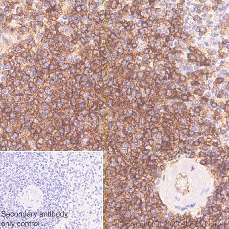 Immunohistochemistry (Formalin/PFA-fixed paraffin-embedded sections) - Anti-HLA Class 1 ABCG antibody [EPR29051-62] (ab323616), expandable thumbnail