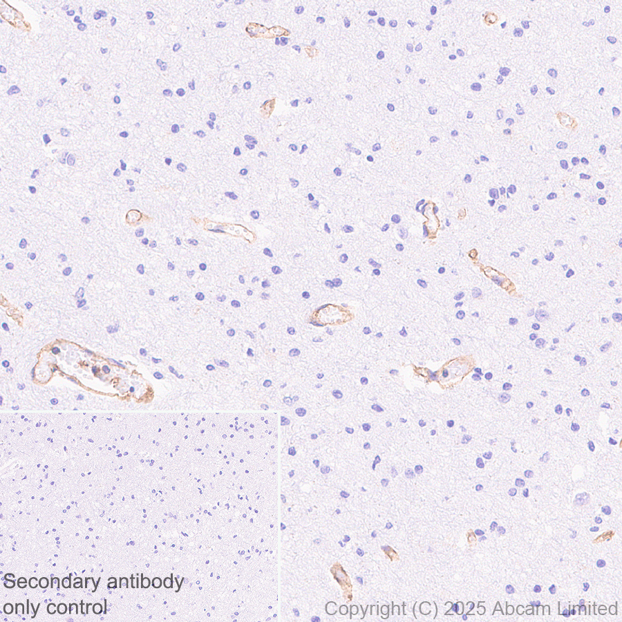 Immunohistochemistry (Formalin/PFA-fixed paraffin-embedded sections) - Anti-HLA Class 1 ABCG antibody [EPR29051-62] (ab323616), expandable thumbnail