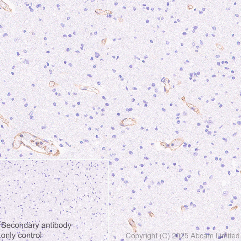 Immunohistochemistry (Formalin/PFA-fixed paraffin-embedded sections) - Anti-HLA Class 1 ABCG antibody [EPR29051-62] (AB323616)