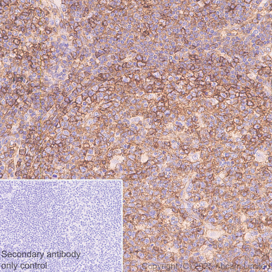 Immunohistochemistry (Formalin/PFA-fixed paraffin-embedded sections) - Anti-HLA Class 1 ABCG antibody [EPR29051-62] (ab323616), expandable thumbnail