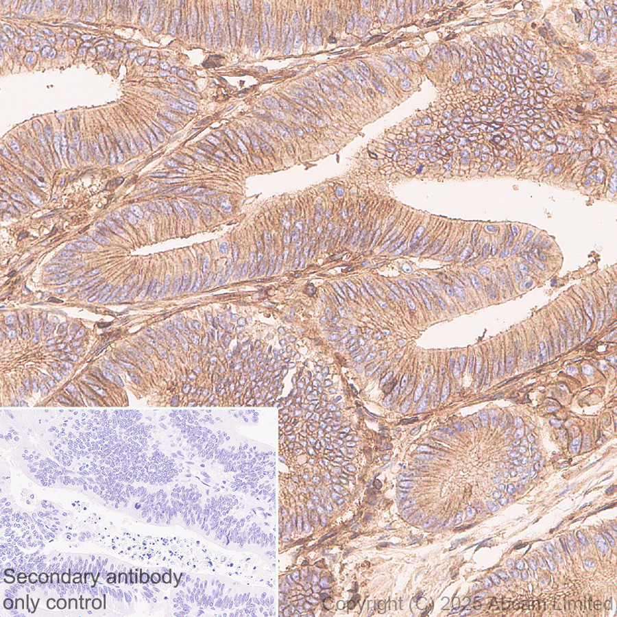 Immunohistochemistry (Formalin/PFA-fixed paraffin-embedded sections) - Anti-HLA Class 1 ABCG antibody [EPR29051-62] (ab323616), expandable thumbnail