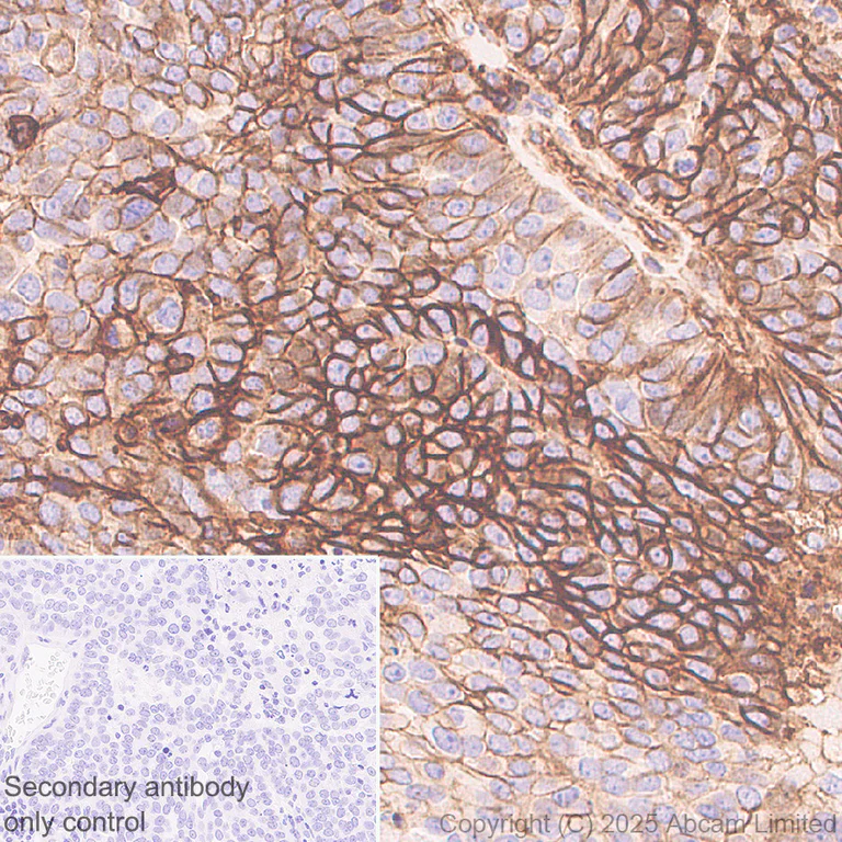 Immunohistochemistry (Formalin/PFA-fixed paraffin-embedded sections) - Anti-HLA Class 1 ABCG antibody [EPR29051-62] (AB323616)