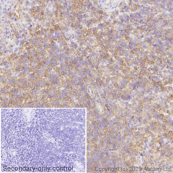 Immunohistochemistry (Frozen sections) - Anti-HLA Class 1 ABCG antibody [EPR29051-62] (AB323616)