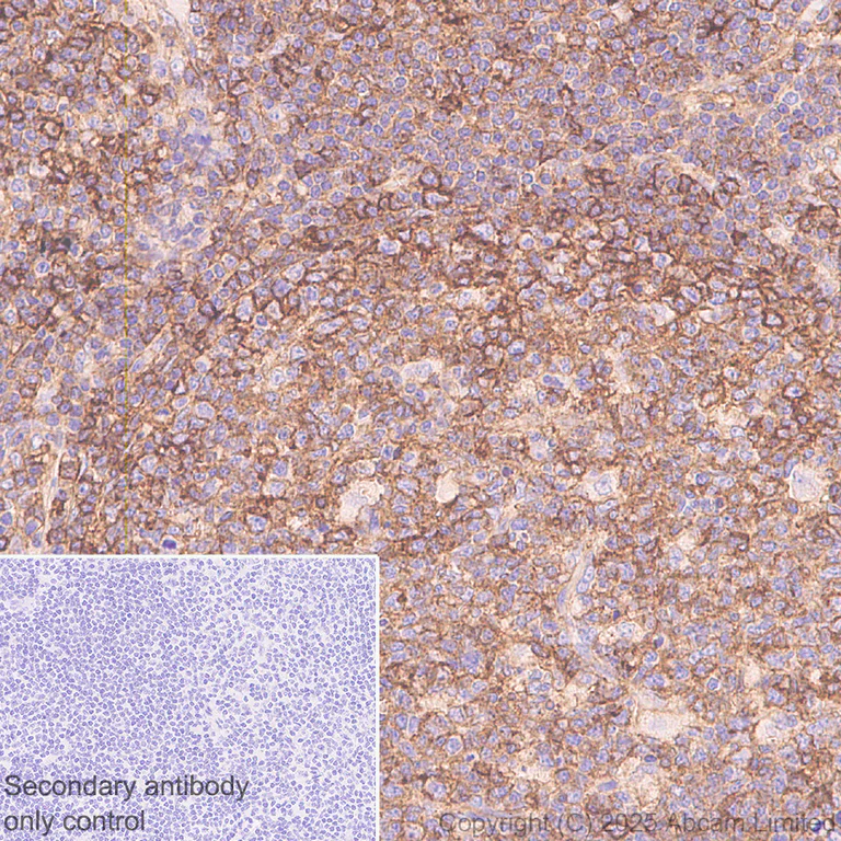 Immunohistochemistry (Formalin/PFA-fixed paraffin-embedded sections) - Anti-HLA Class 1 ABCG antibody [EPR29051-62] - BSA and Azide free (AB323617)