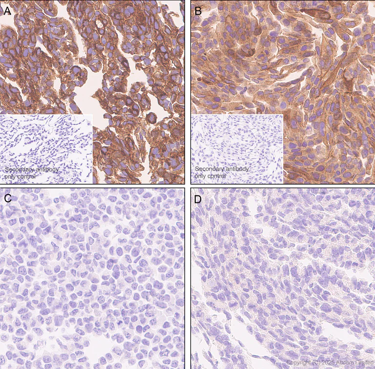 Immunohistochemistry (Formalin/PFA-fixed paraffin-embedded sections) - Anti-HLA Class 1 ABCG antibody [EPR29051-62] - BSA and Azide free (AB323617)