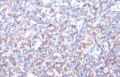 Immunohistochemistry (Formalin/PFA-fixed paraffin-embedded sections) - Anti-HLA class I ABC antibody (AB126237)