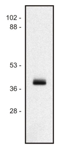 Western blot - Anti-HLA Class I antibody [MEM-147] (AB9090)