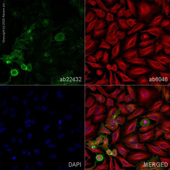 Immunocytochemistry/ Immunofluorescence - Anti-HLA Class I antibody [W6/32] (AB22432), expandable thumbnail