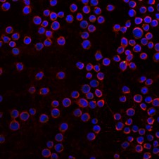 Immunocytochemistry/ Immunofluorescence - Anti-HLA Class I antibody [W6/32] (AB22432), expandable thumbnail