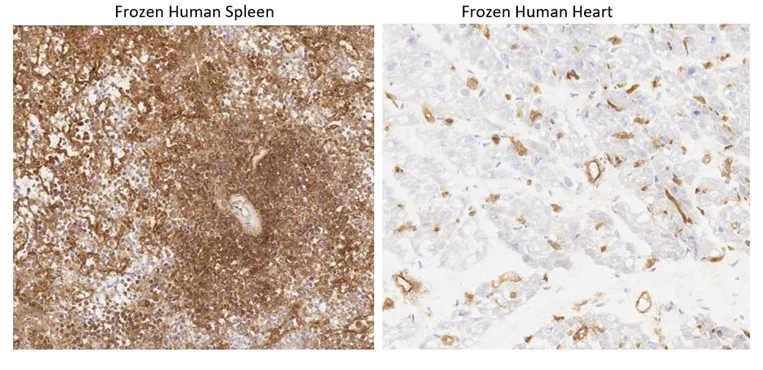 Immunohistochemistry (Frozen sections) - Anti-HLA Class I antibody [W6/32] - BSA and Azide free (AB23755)
