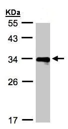 Western blot - Anti-HLA Class II DR4 antibody (AB98106)