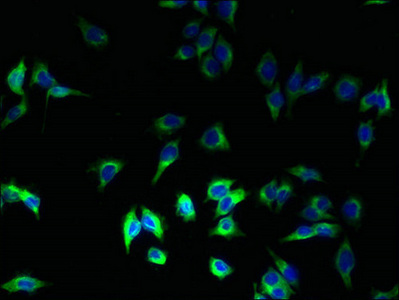 Immunocytochemistry/ Immunofluorescence - Anti-HLA Class II DRB1 antibody (AB235953)