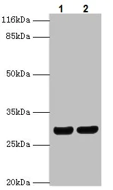 Western blot - Anti-HLA Class II DRB1 antibody (AB235953)