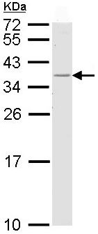 Western blot - Anti-HLA Class II DRB1 antibody (AB98108)