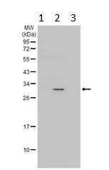 Western blot - Anti-HLA Class II DRB1 antibody (AB98108)