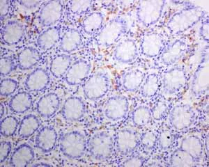 Immunohistochemistry (Formalin/PFA-fixed paraffin-embedded sections) - Anti-HLA Class II DRB1 antibody [EPR6148] (AB133578)