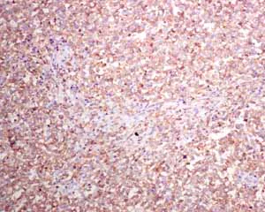 Immunohistochemistry (Formalin/PFA-fixed paraffin-embedded sections) - Anti-HLA Class II DRB1 antibody [EPR6148] (AB133578)