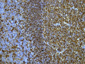 Immunohistochemistry (Formalin/PFA-fixed paraffin-embedded sections) - Anti-HLA Class II DRB1 antibody [EPR6148] (AB133578)