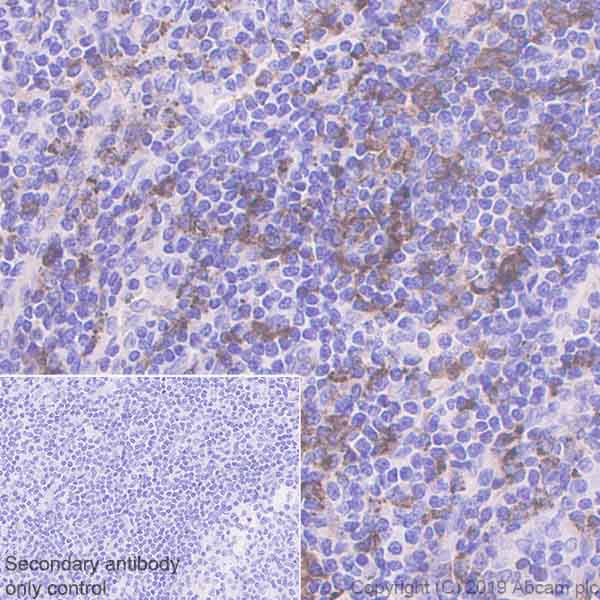 Immunohistochemistry (Formalin/PFA-fixed paraffin-embedded sections) - Anti-HLA Class II DRB1 antibody [EPR6148] (AB133578)