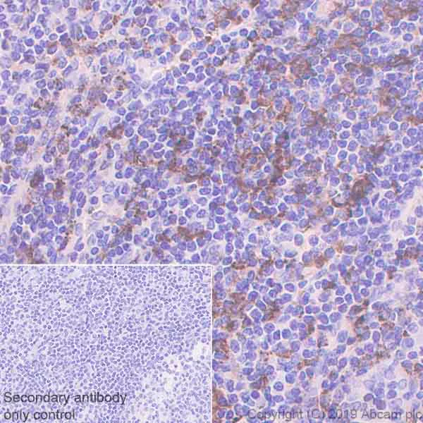Immunohistochemistry (Formalin/PFA-fixed paraffin-embedded sections) - Anti-HLA Class II DRB1 antibody [EPR6148] (AB133578)