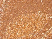 Immunohistochemistry (Formalin/PFA-fixed paraffin-embedded sections) - Anti-HLA Class II DRB1 antibody [HLA-DRB/1067] (AB215835)