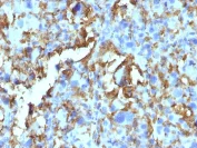 Immunohistochemistry (Formalin/PFA-fixed paraffin-embedded sections) - Anti-HLA Class II DRB1 antibody [HLA-DRB/1067] (AB215835)