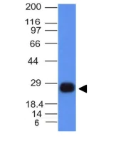 Western blot - Anti-HLA Class II DRB1 antibody [HLA-DRB/1067] (AB215835)