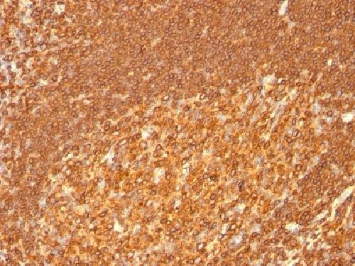Immunohistochemistry (Formalin/PFA-fixed paraffin-embedded sections) - Anti-HLA Class II DRB1 antibody [HLA-DRB/1067] - BSA and Azide free (AB212448)