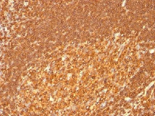 Immunohistochemistry (Formalin/PFA-fixed paraffin-embedded sections) - Anti-HLA Class II DRB1 antibody [HLA-DRB/1067] - BSA and Azide free (AB212448)