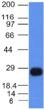 Western blot - Anti-HLA Class II DRB1 antibody [HLA-DRB/1067] - BSA and Azide free (AB212448)