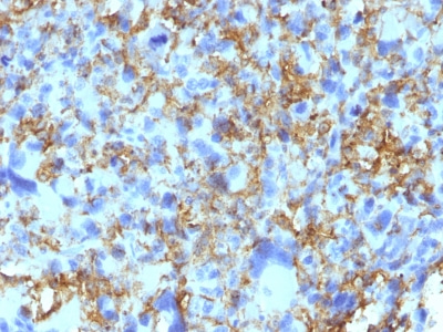 Immunohistochemistry (Formalin/PFA-fixed paraffin-embedded sections) - Anti-HLA Class II DRB1 antibody [LN-3] (AB233877)