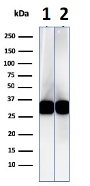 Western blot - Anti-HLA Class II DRB1 antibody [LN-3] (AB233877)