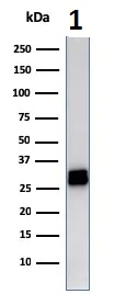 Western blot - Anti-HLA Class II DRB1 antibody [LN-3] (AB233877)