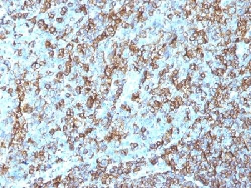 Immunohistochemistry (Formalin/PFA-fixed paraffin-embedded sections) - Anti-HLA Class II DRB1 antibody [LN-3] - BSA and Azide free (AB212444)