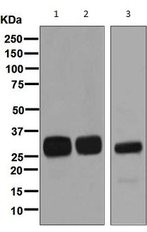 Western blot - Anti-HLA DMB antibody [EPR7981] (AB133640), expandable thumbnail