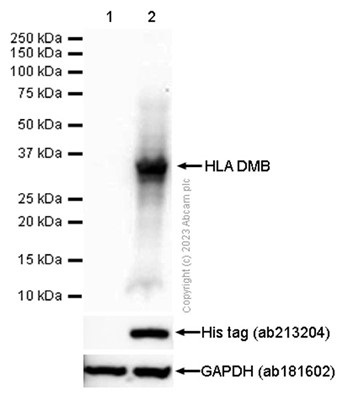 Western blot - Anti-HLA DMB antibody [EPR7981] (AB133640), expandable thumbnail