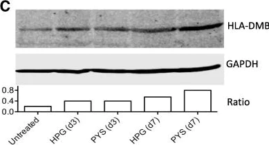 Western blot - Anti-HLA DMB antibody [EPR7981] (AB133640)