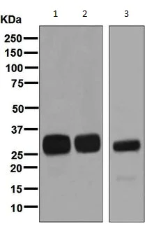 Western blot - Anti-HLA DMB antibody [EPR7981] - BSA and Azide free (AB248588)