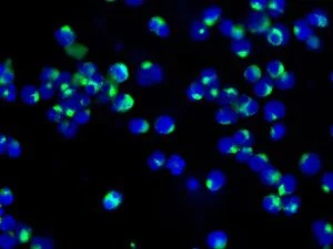 Immunocytochemistry/ Immunofluorescence - Anti-HLA DMB antibody [EPR7982] (AB131273)