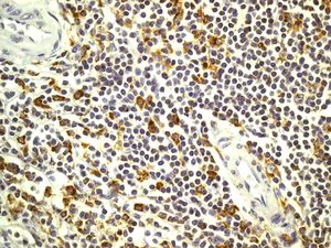 Immunohistochemistry (Formalin/PFA-fixed paraffin-embedded sections) - Anti-HLA DMB antibody [EPR7982] - BSA and Azide free (AB248398)