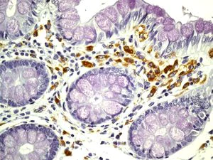 Immunohistochemistry (Formalin/PFA-fixed paraffin-embedded sections) - Anti-HLA DMB antibody [EPR7982] - BSA and Azide free (AB248398)